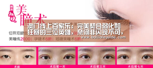 澳门线上百家乐:完美契合弱化和狂暴的三位英雄,奈何非闪现不可,只能无奈放弃!(图3) 百家乐入口
